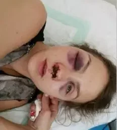 Продюсера телеканала «Россия 1″ Юлию Бондареву избили в Ессентуках