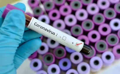 Пандемия 19 марта: в России, в Ставропольском крае и в мире