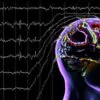 Диагностировать болезни головного мозга и нервной системы в Кисловодске поможет новый электроэнцефалограф