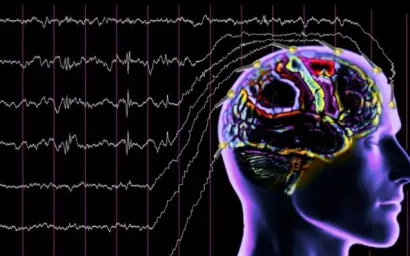 Диагностировать болезни головного мозга и нервной системы в Кисловодске поможет новый электроэнцефалограф