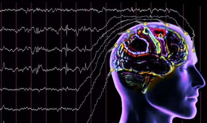 Диагностировать болезни головного мозга и нервной системы в Кисловодске поможет новый электроэнцефалограф
